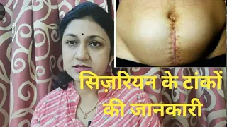 Cesarean ke tankon ki dekhbhal सिजेरियन के टाकों की देखभाल