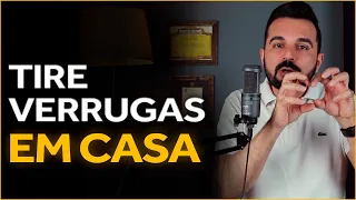 Verrugas Nunca Mais: Duas Receitas Infalíveis Para Remover As Suas - Dr. Rafael Freitas