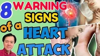 8 Warning Signs of Heart Attack - by  Doc Willie Ong