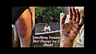 Hey Yo Something Traumatic That Changed My Life Check Pt.1 *Trigger Warning | TikTok Compilation