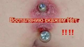 Ошибки при обработке пупка ‼️Все важно до мелочей знать о проколах .🔥выпуск 2.