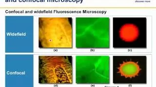 Principles and practice of confocal microscopy in life sciences