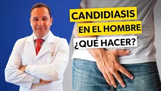 Cómo librarse de la CANDIDIASIS MASCULINA rápidamente