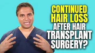 Continued Hair Loss After Having Hair Transplant Surgery?