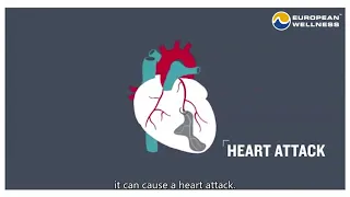 How to Prevent Strokes & Heart Attacks | European Wellness