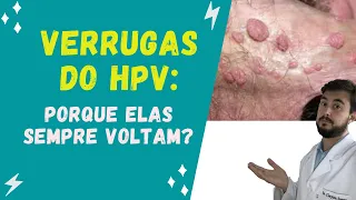 Porque as verrugas do HPV podem voltar??