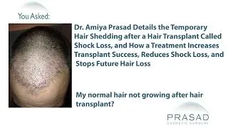 The Temporary Cause of Hair Shedding after a Hair Transplant and How to Stop it and Future Hair Loss