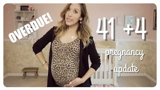 overdue pregnancy update | ways to induce labor?!