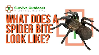 What Does a Spider Bite Look Like?