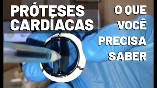 PRÓTESES CARDÍACAS - DR SERGIO FRANCISCO