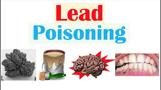 Lead Poisoning (Lead Toxicity) | Sources, Pathophysiology, Signs & Symptoms, Diagnosis, Treatment