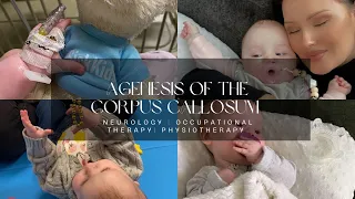 Agenesis of the Corpus Callosum | Neurology | Occupational Therapy | Physiotherapy