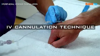 Intravenous Cannulation Technique