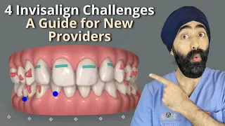 4 Invisalign Challenges for New Dentists  A Guide for New Providers -  PDP116