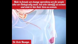 Male to female sex change operations are for people are biologically male, but who identify as women