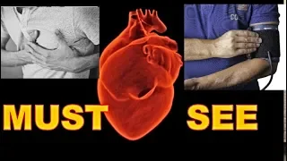 Chest pain: Pulled a muscle, Stress related, Heartburn, or a Heart Attack