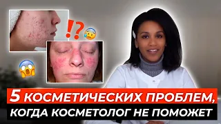 Не совершайте этих ошибок!! Когда косметолог не поможет: 5 типичных ситуаций