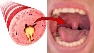 THIS is how you can get rid of mucus in your throat in just two minutes 💥 (Surprisingly easy) 🤯