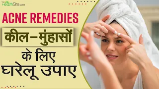 Acne Remedies: Natural Remedies For Pimples | How To Remove Pimples | Home Remedies For Pimples