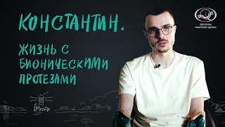 Константин. Жизнь с бионическими протезами. Интервью для вМесте