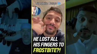 Unreal, He Lost All His Fingers to Frostbite?! 🥶 #shorts