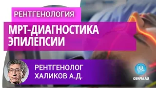 Рентгенолог Халиков А.Д.: МРТ-диагностика эпилепсии