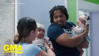 Formerly conjoined twin goes home 2 months after surgery l GMA