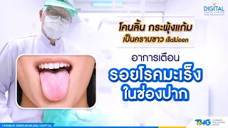 รอยโรคมะเร็งในช่องปาก - รศ.ดร.ทพ.สรสัณห์ รังสิยานนท์ | 𝐃𝐢𝐠𝐢𝐭𝐚𝐥 𝐃𝐞𝐧𝐭𝐚𝐥 𝐂𝐞𝐧𝐭𝐞𝐫