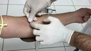 Administração por Via Endovenosa c/scalp