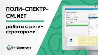 Проведение суточного мониторирования ЭКГ по Холтеру с помощью Поли-Спектр-СМ