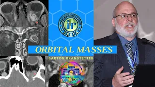 Orbital Masses Pattern Recognition by Dr Barton Branstetter