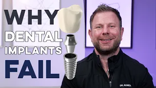 Problems With Dental Implants!