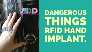 RFID Transponder Chip Implant