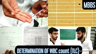 Determination of WBC count (TLC -Total leucocyte count) | MUHS | #mbbs #practical #hematology