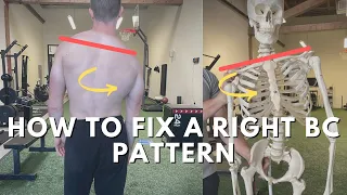 How to Fix a Right BC Pattern - Steps For Addressing Upper Body Asymmetry