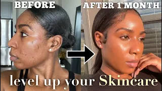 THE SKINCARE ROUTINE THAT CHANGED MY LIFE | MICRONEEDLING + HOW TO FADE DARK SPOTS & CLEAR ACNE FAST