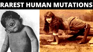 Rarest Human Mutations | Probability Comparison