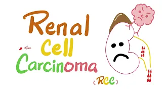 Renal Cell Carcinoma (RCC) | Kidney Tumors | Neoplasms | Renal Pathology | Nephrology