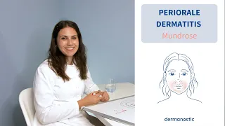 Periorale Dermatitis - Entzündlicher Hautausschlag um den Mund│Dr. med. Alice Martin