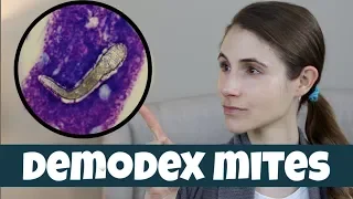 DEMODEX MITES ON YOUR SKIN| DR DRAY