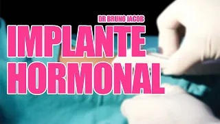 VOCÊ SABE O QUE É IMPLANTE HORMONAL? › saiba se você precisa! ‹