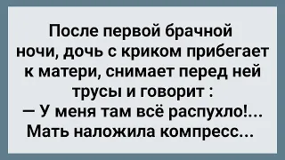 После Первой Брачной Ночи Мать Наложила Дочке Компресс! Сборник Свежих Анекдотов! Юмор!