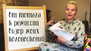 От тотального НЯК к эндоскопической ремиссии: обзор результатов моих колоноскопий