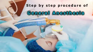 General anesthesia  |  step by step procedure