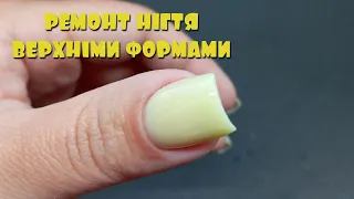 IT DOESN'T LOOK LIKE IT FROM THE SALON ANYMORE! REPAIR OF THE NAIL IN TOP FORMS