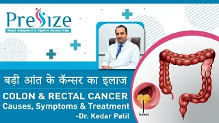 बड़ी आंत के कॅन्सर का इलाज | Colon & Rectal Cancer | Causes, Symptoms & Treatment - Dr. Kedar Patil