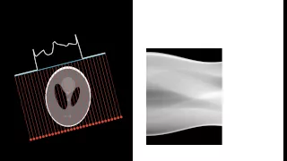 Collection of tomographic data from Shepp-Logan phantom