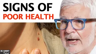 4 WARNING SIGNS You Need To Go To Your DOCTOR! | Dr. Steven Gundry