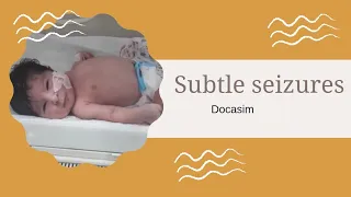 subtle seizures | neonatal seizures