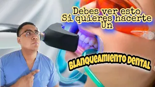 7 consejos que debes saber antes de realizarte un blanqueamiento dental